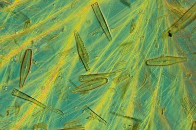 养殖的螃蟹吃什么，可以喂食天然性饵料、人工动物性饵料等