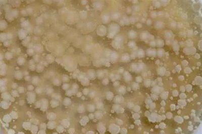 枯草芽孢杆菌对农作物有什么作用,有抗拮、杀菌溶菌的作用