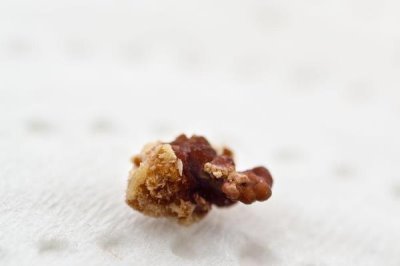 狗得了结石怎么办，结石较小且症状不严重可选择药物治疗