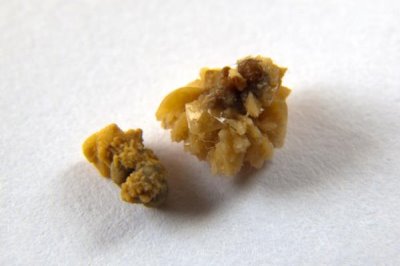 狗得了结石怎么办，结石较小且症状不严重可选择药物治疗